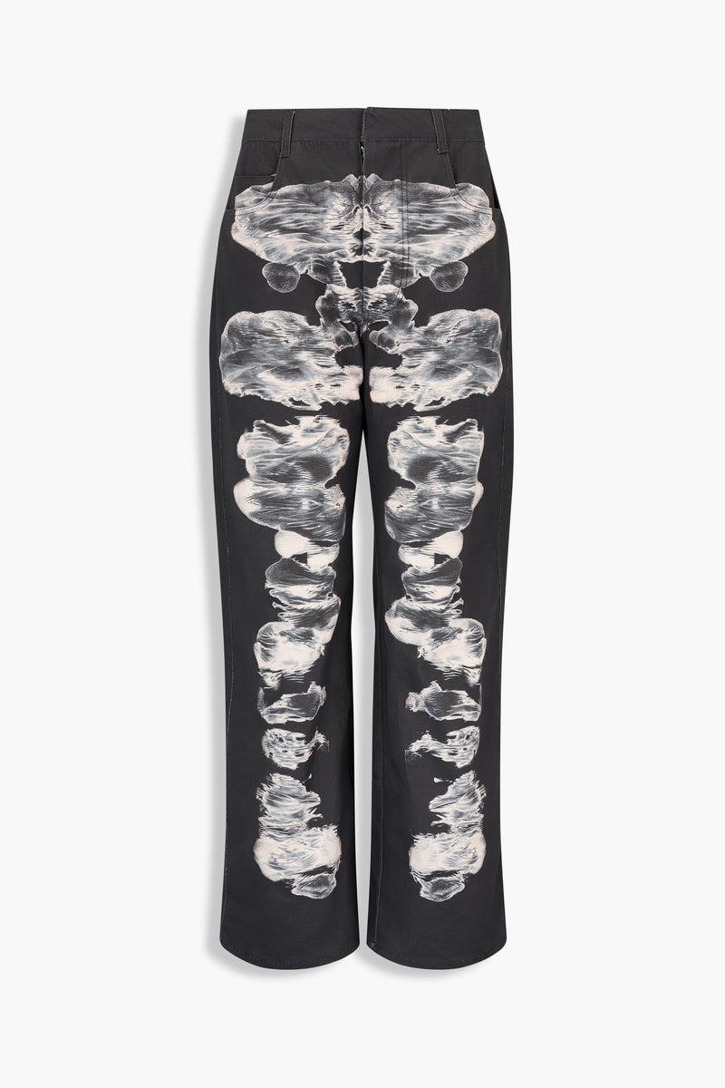 Alienis Print Jeans in Black
