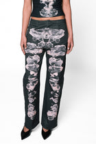 Alienis Print Jeans in Black